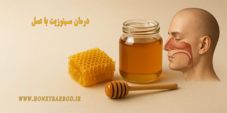 درمان سینوزیت با عسل؛ روش علمی و موثر همراه با خواص کامل